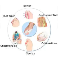 Correcteur de Hallux Valgus en Silicone