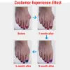 Correcteur de Hallux Valgus en Silicone
